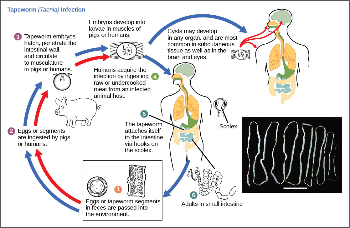 Taenia saginata infection