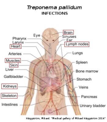 Treponema pallidum infections